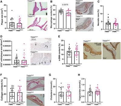 Deficiency of germinal center kinase TRAF2 and NCK-interacting kinase (TNIK) in B cells does not affect atherosclerosis